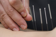 Thumbnail 80 Acupuncture Articles - High Quality Articles - PLR Thumbnail 80 Acupuncture Articles - High Quality Articles - PLR